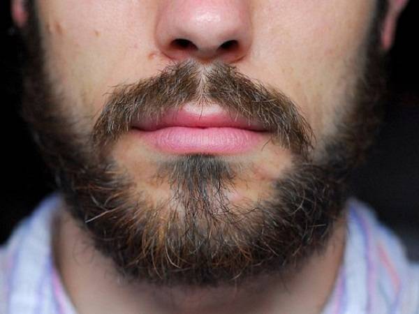 Алопеция на бороде у мужчин: причины и симптомы