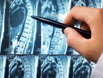 Диагностику и локализацию причины боли проводят с помощью МРТ