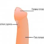 Короткая уздечка полового члена — симптомы и способы лечения уздечка полового члена в клинике ЦЕЛТ