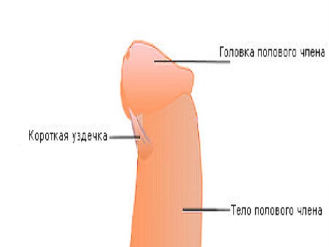 Короткая уздечка полового члена — симптомы и способы лечения уздечка полового члена в клинике ЦЕЛТ