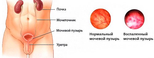 Мужские болезни по урологии: симптомы - News4Health.ru