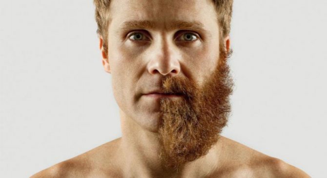 Неравномерный рост бороды: что делать если пусто на щеках или рост заметен только с одной стороны