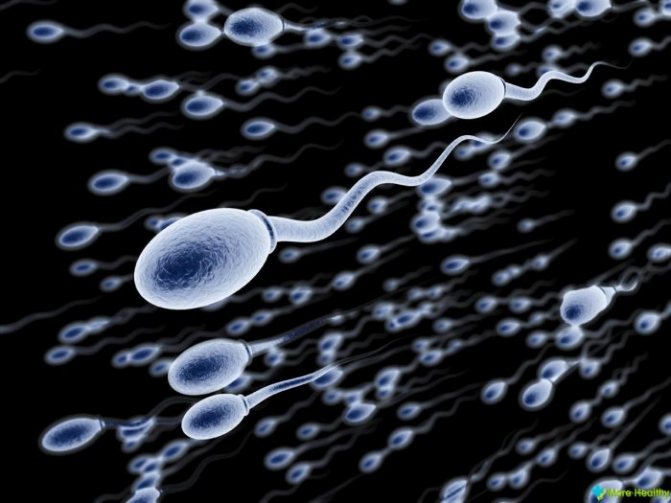 присутствие лейкоцитов в сперме